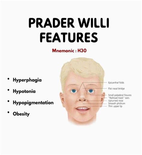 prada willi syndrome symtoms|characteristics of prader willi syndrome.